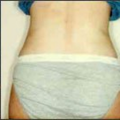After: Waist/Hips/Outer Thighs