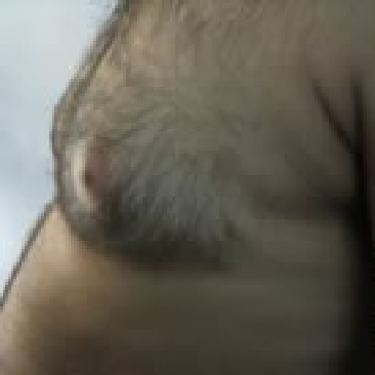 Before: Breasts, Male