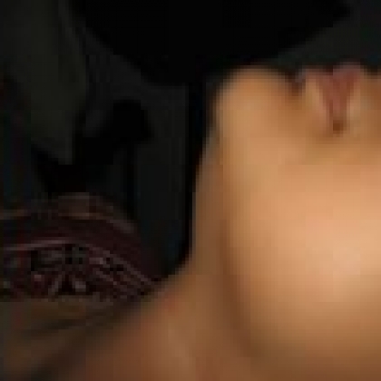 After: Face and Neck