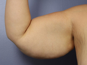 Before: Arms